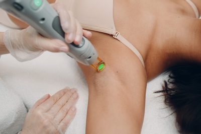 Laser,Epilation,Of,Armpits,And,Cosmetology.,Hair,Removal,Cosmetology,Procedure.